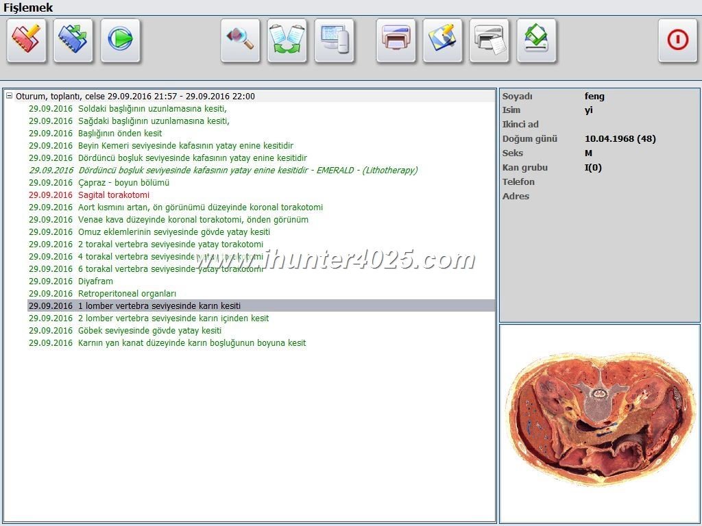 Maikong Metatron Hunter 4025 NLS 10