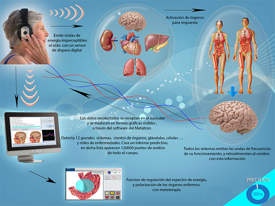Metatron NLS System 1
