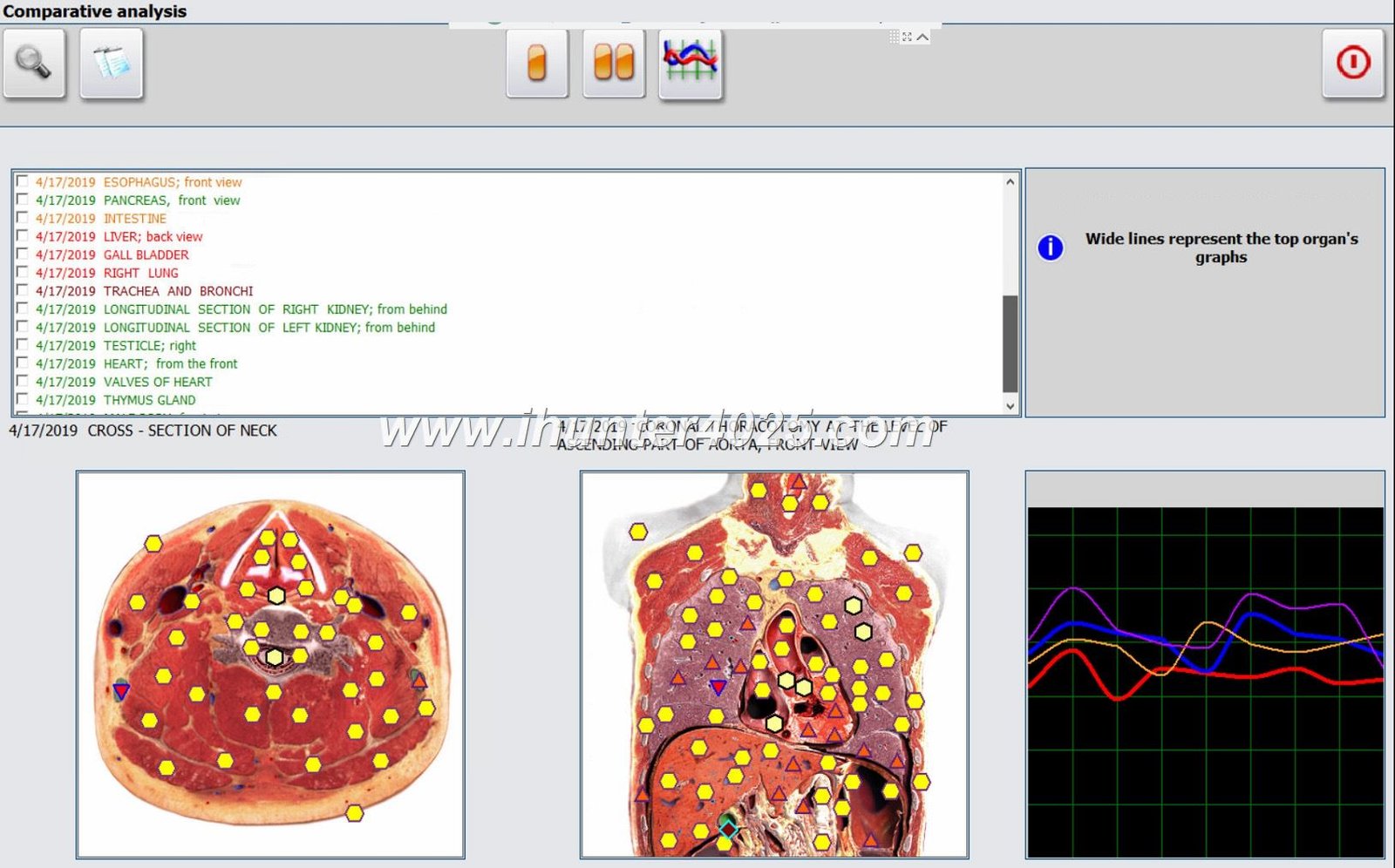 Analizator 4025 Metatron Hunter 11