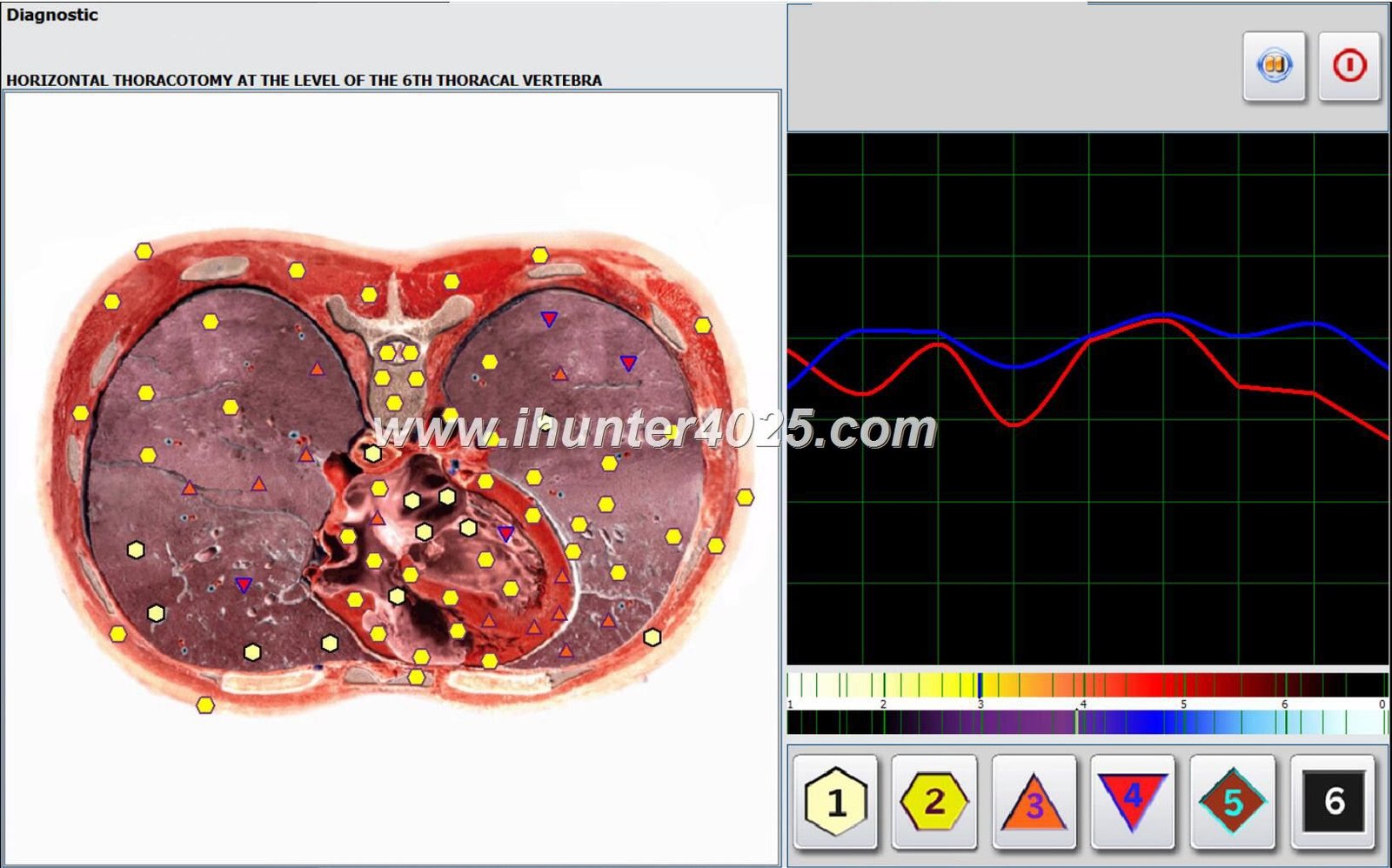 Analizator 4025 Metatron Hunter 7 1