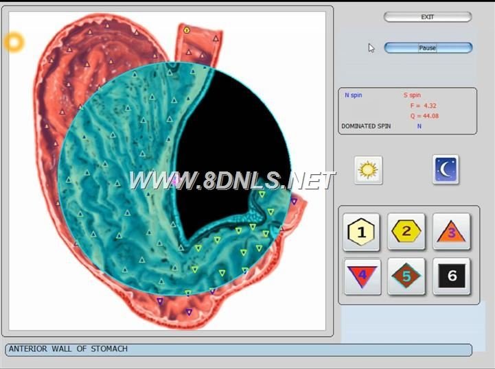 Maikong Biorezonans NLS 17D LRIS