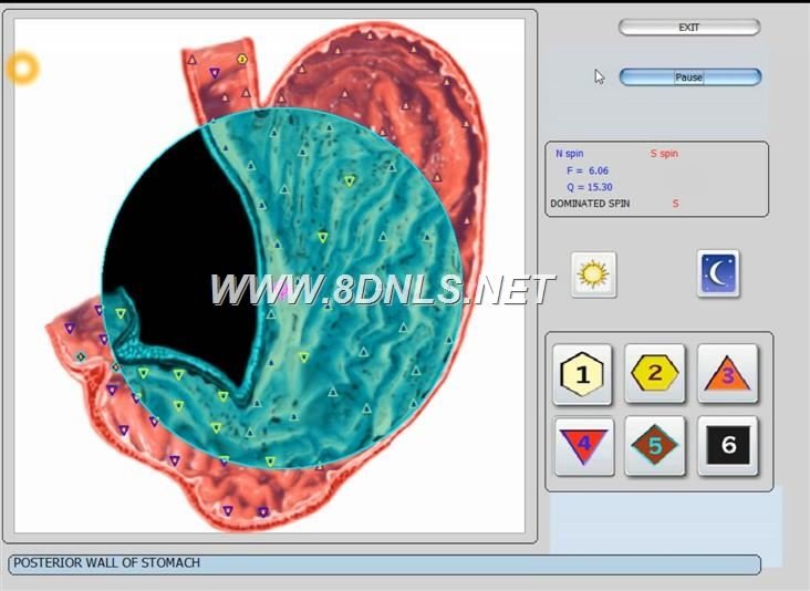 Maikong Biorezonans NLS 17D LRIS