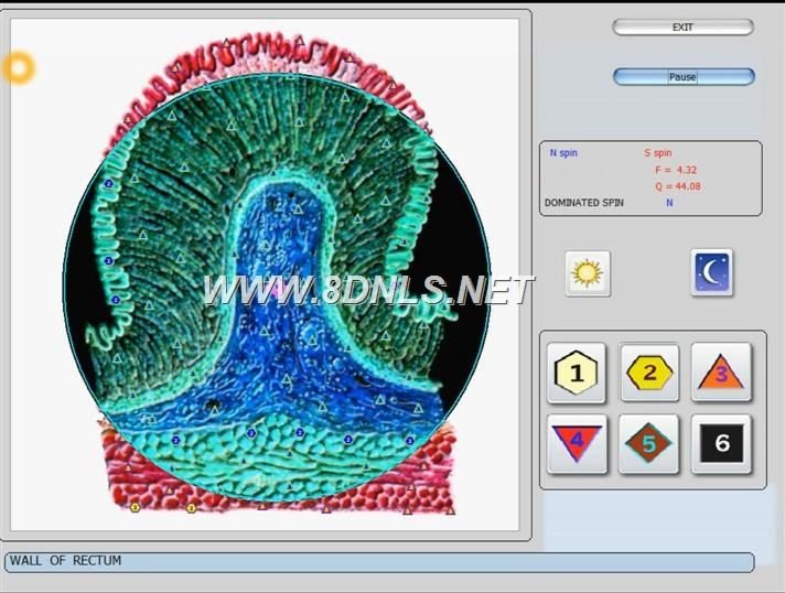 Hunter 4025 Metatron 11